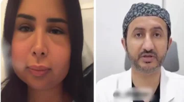 طبّيب استشاري يوضح أسباب تورم وانتفاخ وجه دانا الشهري بعد فشل عملية التجميل